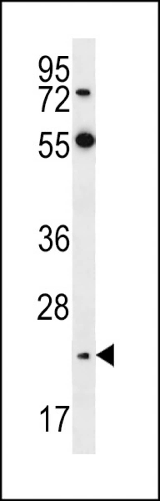 ANTI-NEUROGENIN2, 0,1 MG