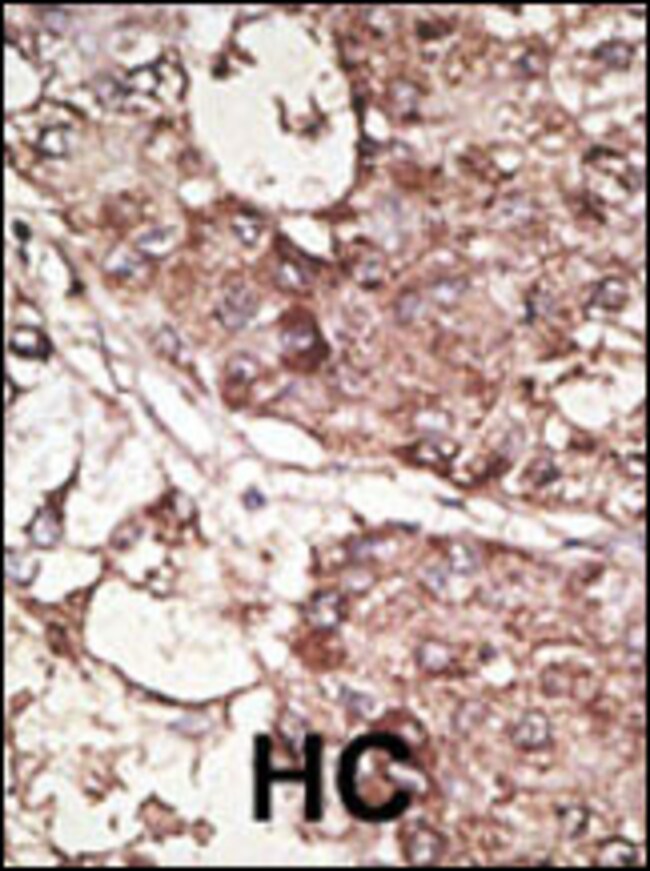 ANTI-THY1, 0,1 MG