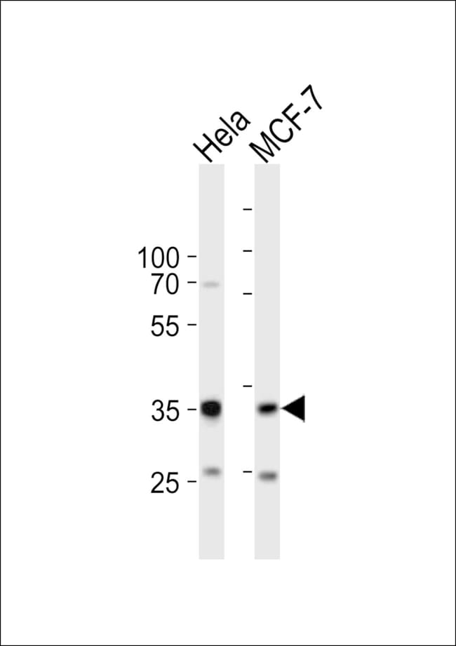 ANTI-SNAI1, 0,1 MG