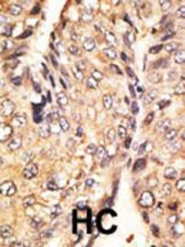 ANTI-GDF10, 0,1 MG