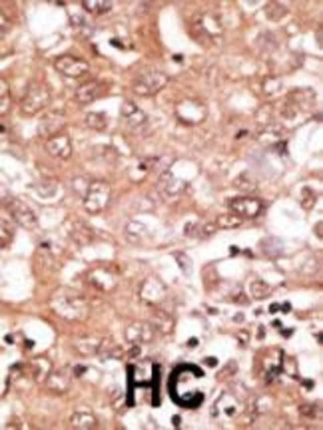 ANTI-BMP9, 0,1 MG