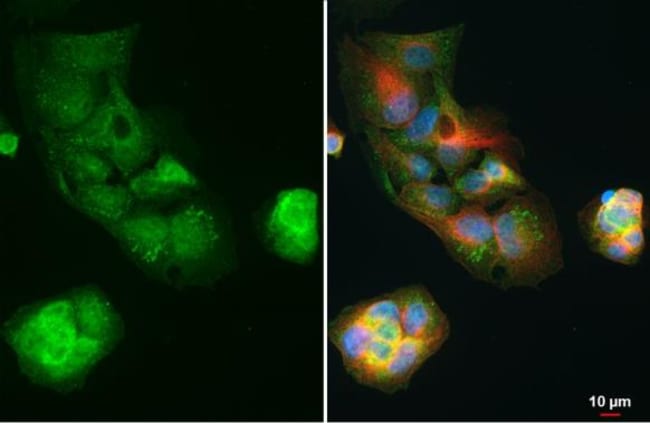 100UL APOE (R136S MUTANT) ANTIBODY 100 U