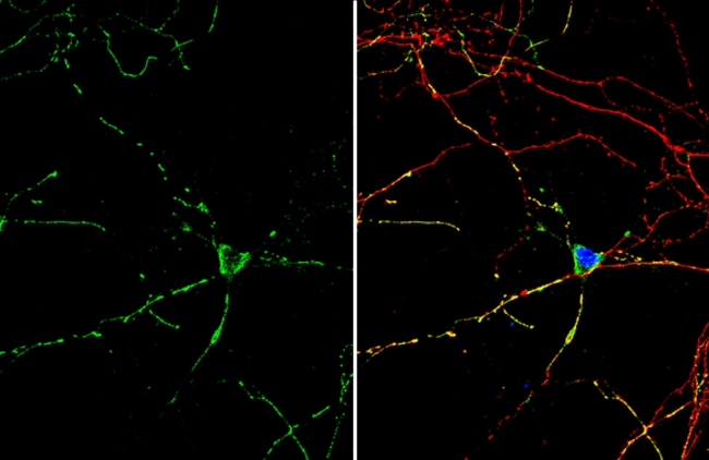 100UL BETA-HYDROXY-GABA ANTIBODY 100 UL