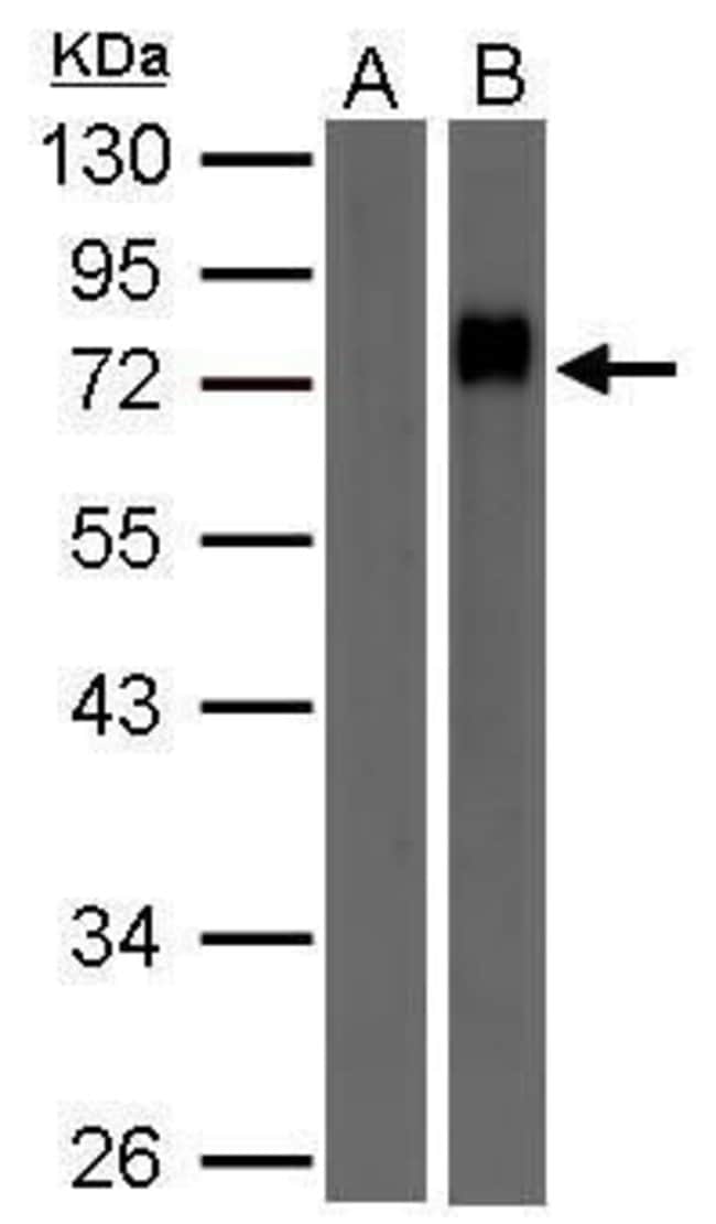 100UL BIOTIN ANTIBODY 100 UL