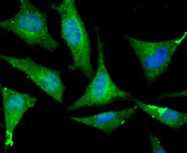 100UL ATP CITRATE LYASE ANTIBODY 100 UL