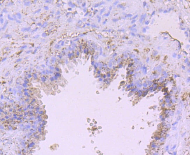 100UL ADAM10 ANTIBODY 100 UL