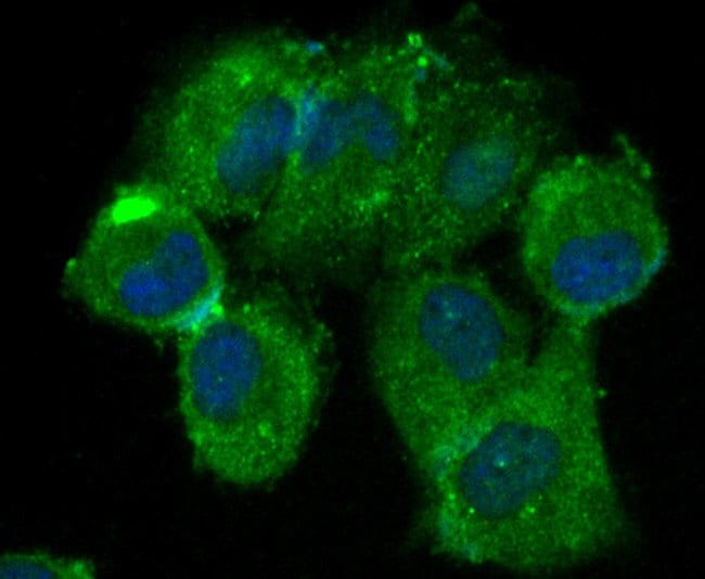 100UL BETA ARRESTIN 1 ANTIBODY 100 UL