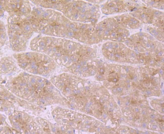 100UL APOC3 ANTIBODY 100 UL