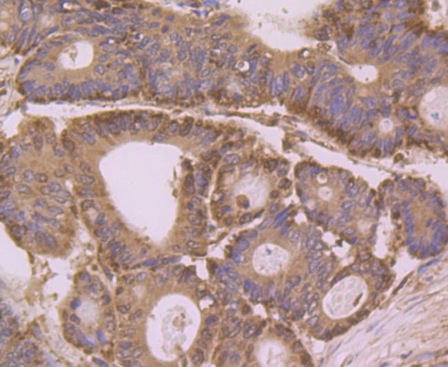 100UL ANNEXIN A3 ANTIBODY 100 UL
