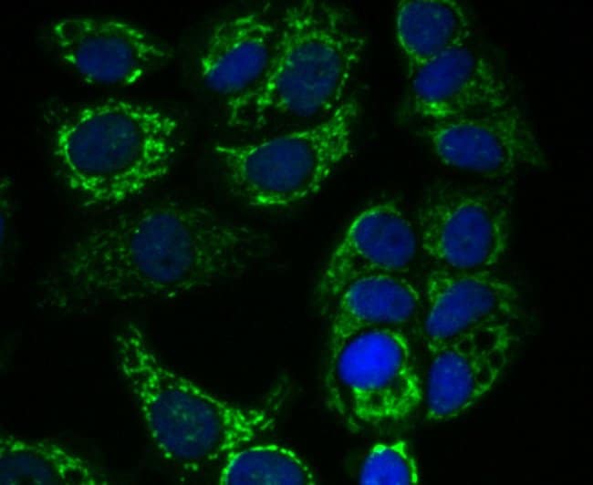 100UL ALPHA-1 MICROGLOBULIN ANTIBODY 100