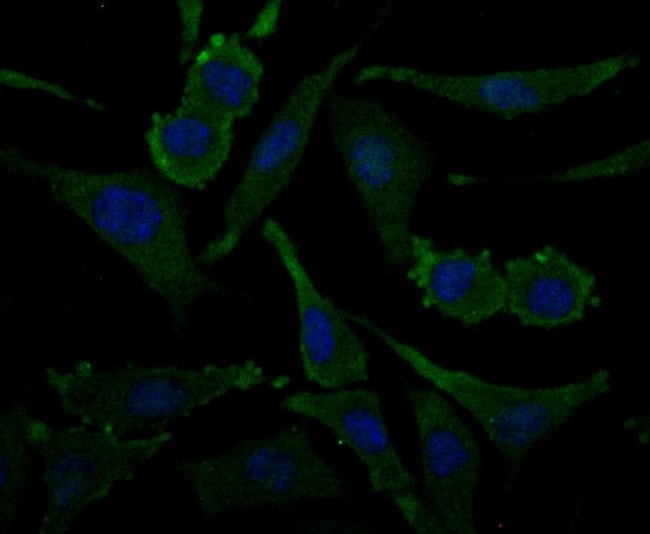 100UL AMINOACYLASE ANTIBODY 100 UL