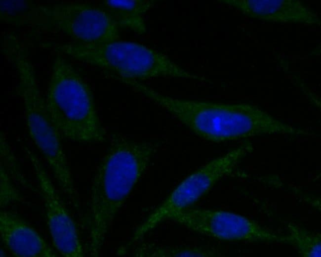 100UL ACADM ANTIBODY 100 UL