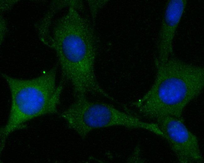 100UL ADAM22 ANTIBODY 100 UL