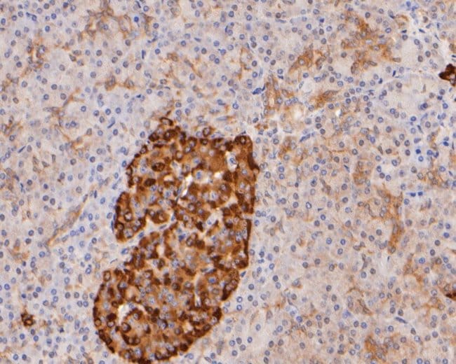 100UL APOLIPOPROTEIN J ANTIBODY 100 UL