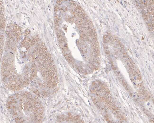 100UL ADK ANTIBODY 100 UL