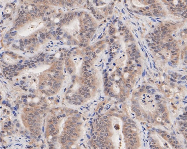 100UL ASNA1 ANTIBODY 100 UL