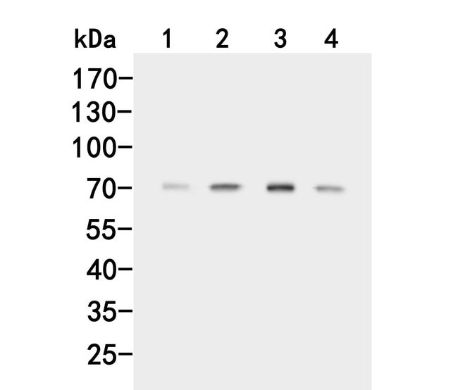 100UL ACVR2A ANTIBODY 100 UL