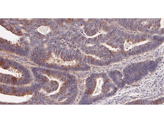 100UL ADSL ANTIBODY 100 UL