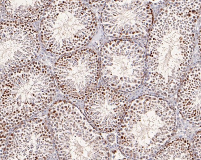 100UL ATG14 ANTIBODY 100 UL