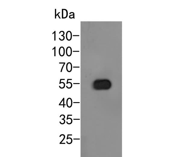 100UL AROGENATE DEHYDRATASE ANTIBODY 100