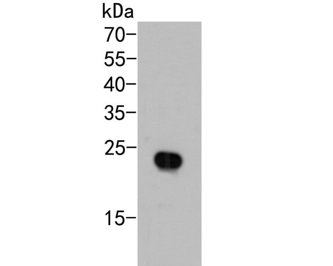 100UL AP REPEAT ANTIBODY 100 UL