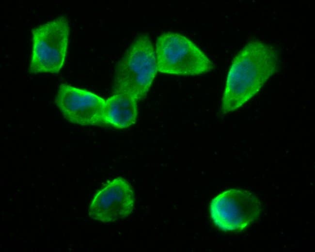 100UL BETA GALACTOSIDASE ANTIBODY 100 UL