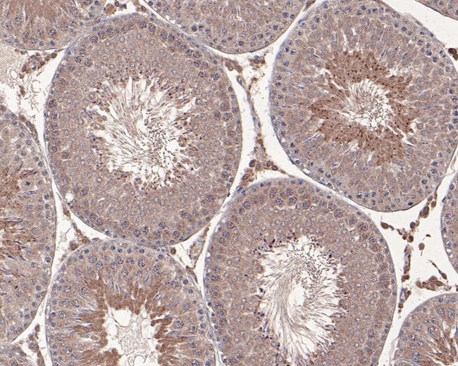 100UL AMH ANTIBODY 100 UL
