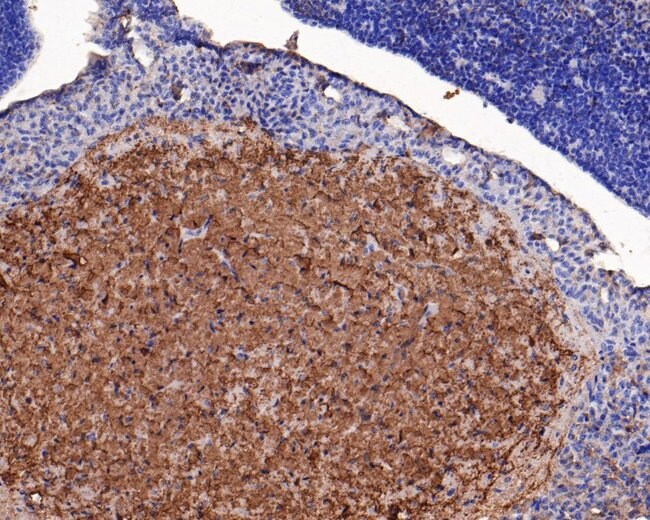 100UL ASIC4 ANTIBODY 100 UL