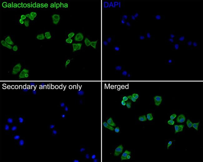 100UL ALPHA GALACTOSIDASE ANTIBODY 100 U
