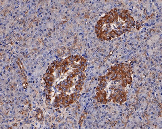 100UL ATGL ANTIBODY 100 UL