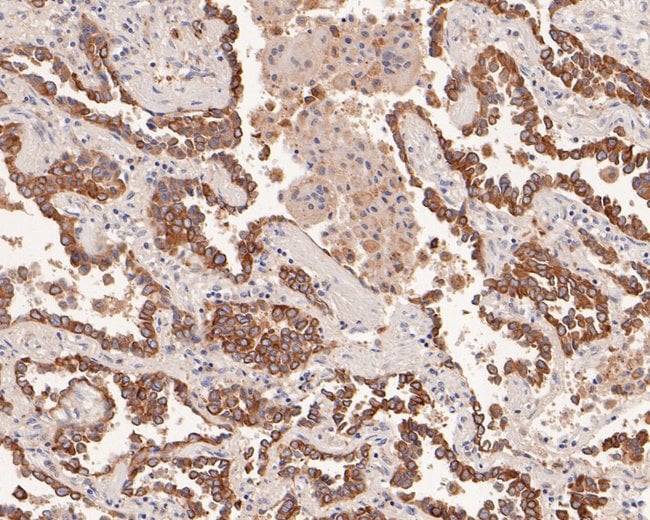 100UL AMHR2 ANTIBODY 100 UL