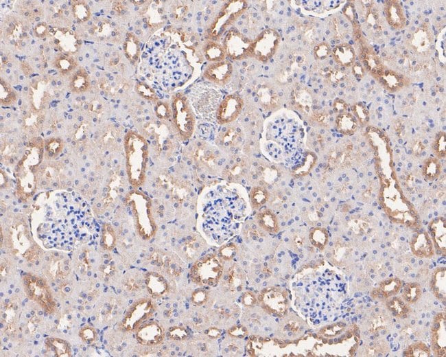 100UL ARHGEF18 ANTIBODY 100 UL