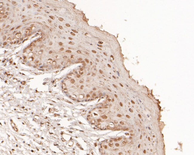 100UL ATP1B4 ANTIBODY 100 UL