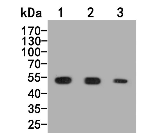100UL BMP-10 ANTIBODY 100 UL