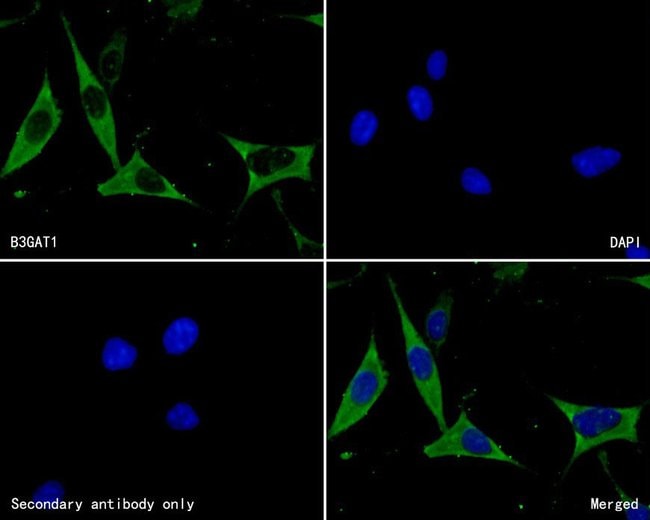 100UL B3GAT1 ANTIBODY 100 UL