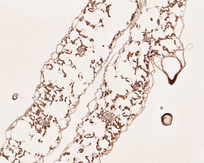 100UL AP4M1 ANTIBODY 100 UL