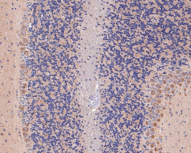 100UL AP2A2 ANTIBODY 100 UL