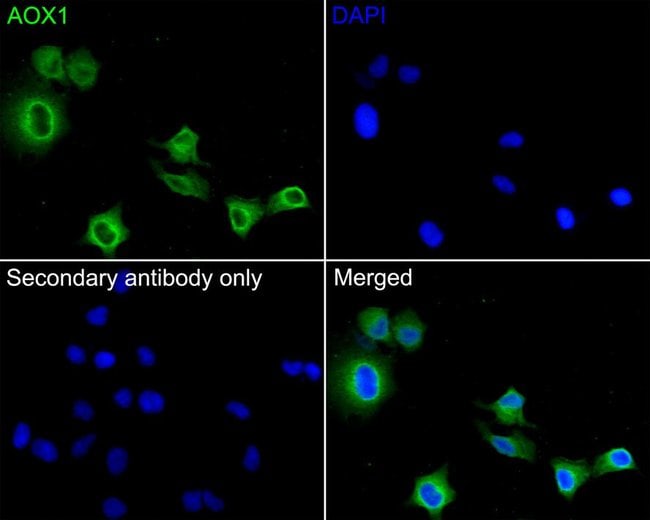 100UL AOX1 ANTIBODY 100 UL