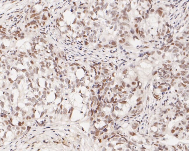 100UL ASH2L ANTIBODY 100 UL