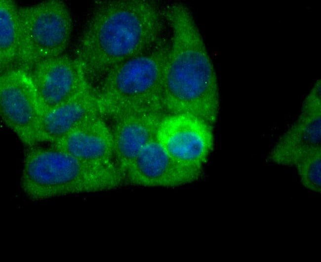 100UL ALDH1A1 ANTIBODY 100 UL