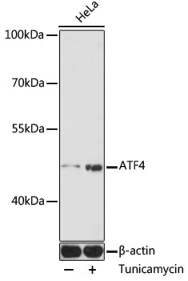 100UL ATF4 ANTIBODY 100 UL