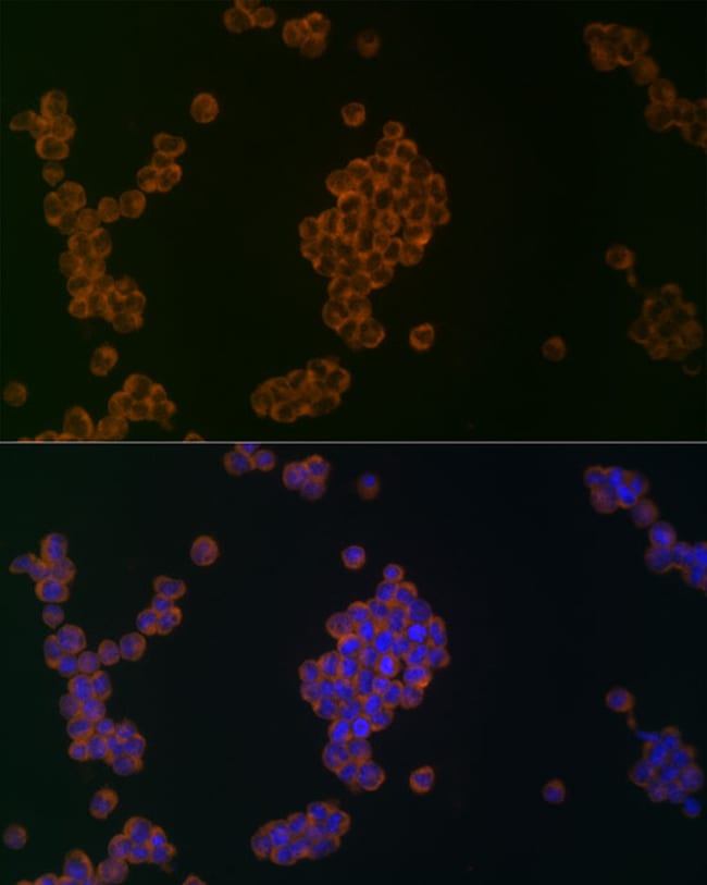100UL ATG5 ANTIBODY 100 UL