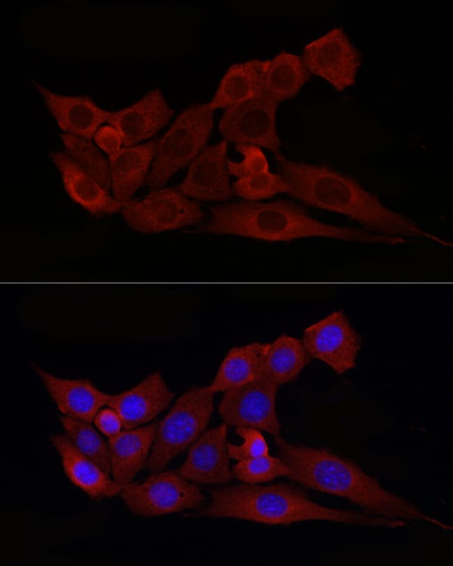 100UL BAX ANTIBODY 100 UL