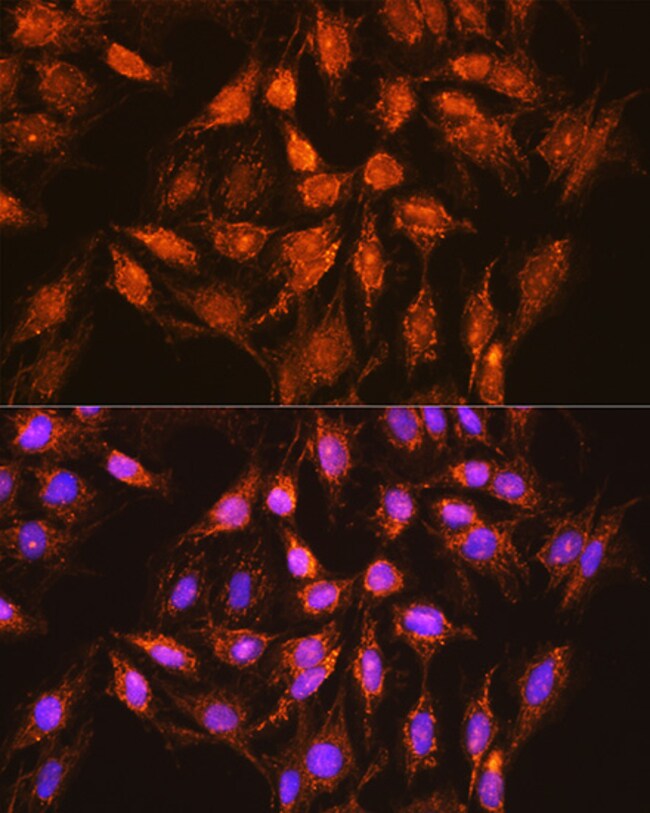 100UL BCL-XL ANTIBODY 100 UL