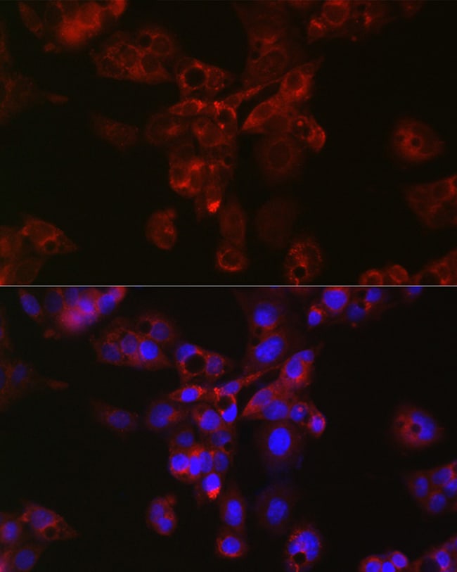 100UL APOE ANTIBODY 100 UL