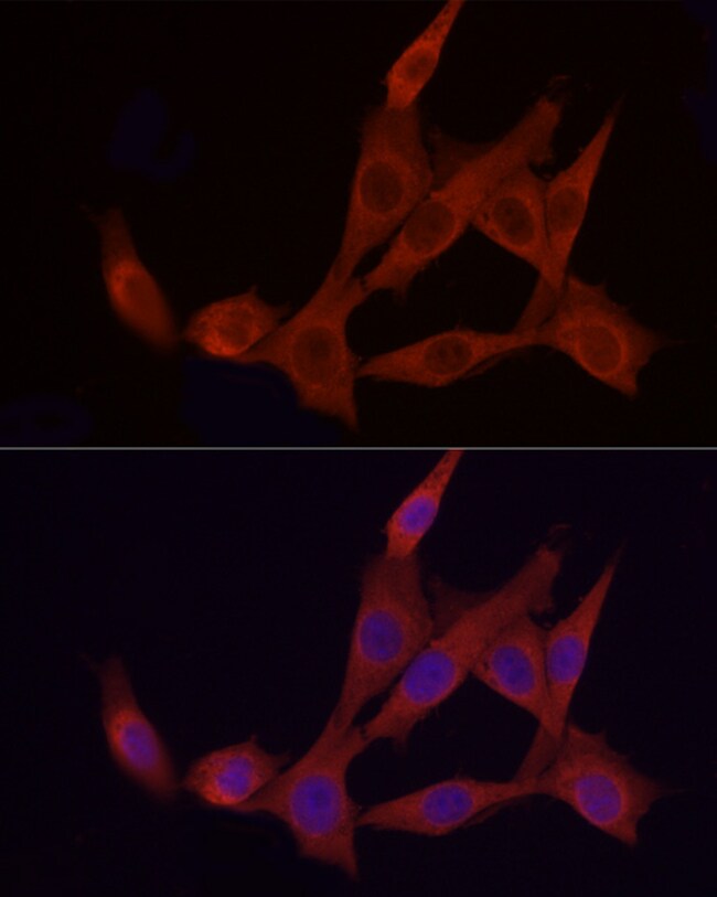 100UL APAF1 ANTIBODY 100 UL