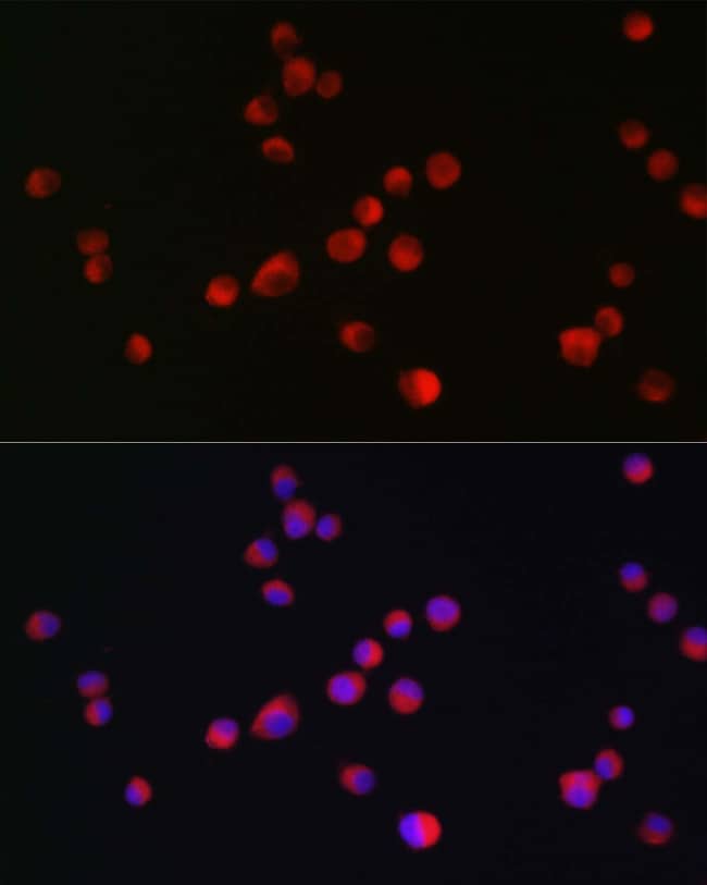 100UL ALK ANTIBODY 100 UL