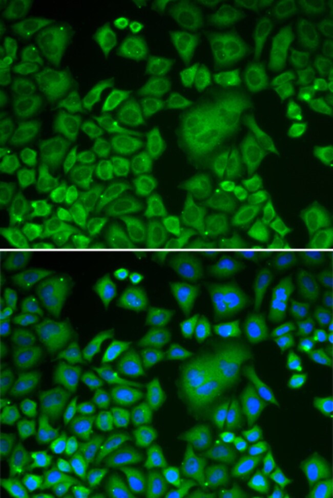 100UL ARP3 ANTIBODY 100 UL