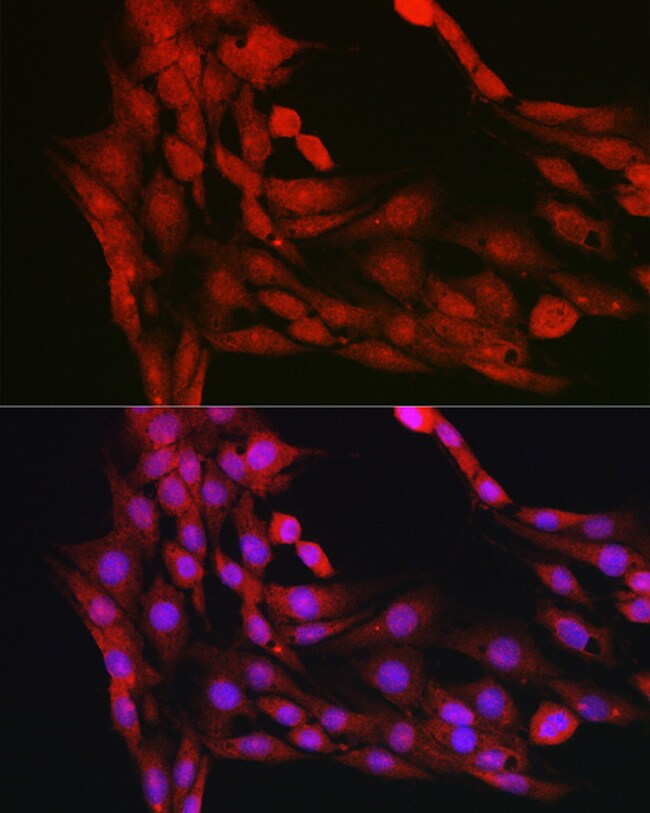 100UL AKT1 ANTIBODY 100 UL