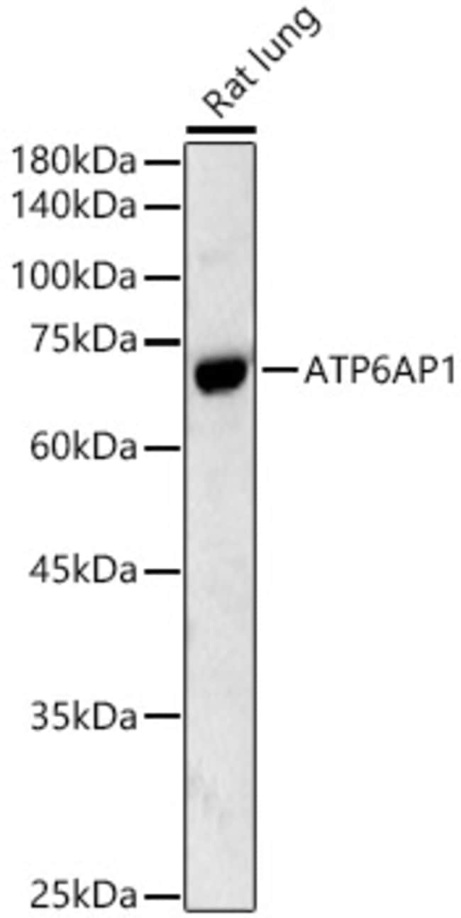 100UL ATP6AP1 ANTIBODY 100 UL